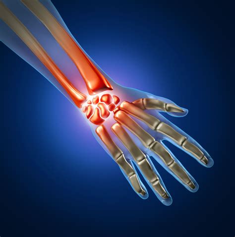 Orthopedic Hand & Wrist Surgery in Plano, Frisco, McKinney and Allen