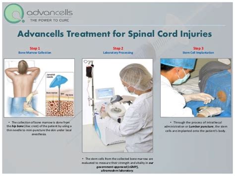 Spinal cord injuries Treatment | Stem Cell Treatment For Spinal Cord