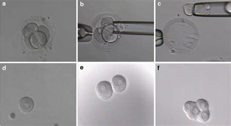 Isolation and culture of single blastomeres. From a 4-cell stage embryo ...