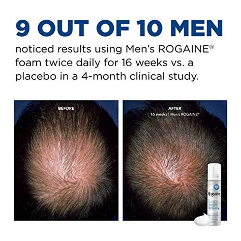 Men's Rogaine 5% Minoxidil Foam for Hair Loss and Hair Regrowth, Topical Treatment for Thinning ...