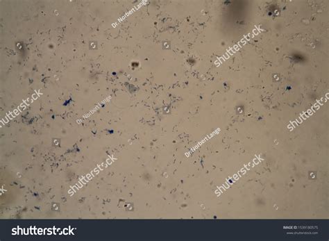 Tuberculosis Bacteria Under Microscope 400x Stock Photo 1539180575 ...