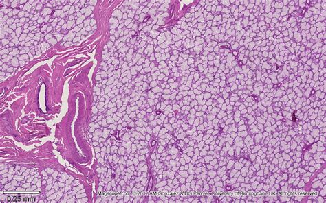 Low magnification micrograph illustrating the structure of a sublingual gland