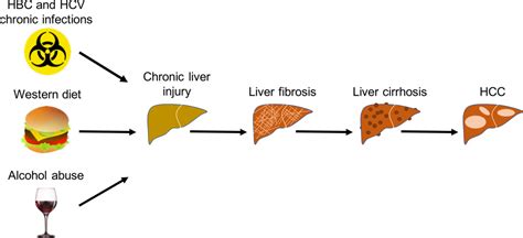 Liver fibrosis: Pathophysiology and clinical implications - Berumen - 2021 - WIREs Mechanisms of ...