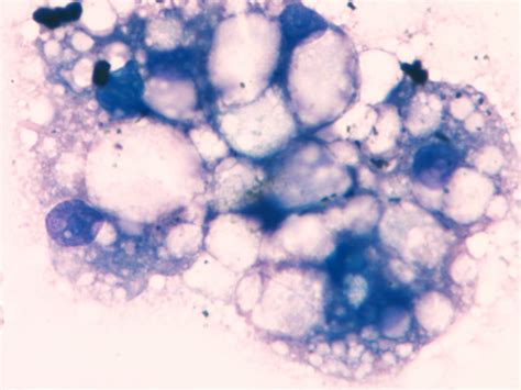 Hepatic lipidosis | eClinpath