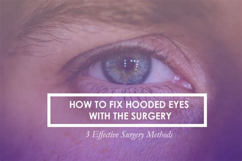 How to fix hooded eyes with surgery? - JW Plastic Surgery