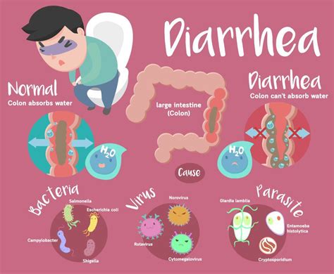 What Is Diarrhea Causes Symptoms And Home Remedies – NBKomputer