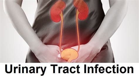 Signs And Symptoms Of Bladder Infection ( Urinary Tract Infection / Cystitis ) | Health And Beauty