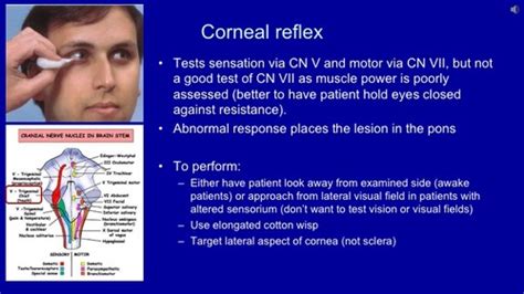 Corneal Reflex