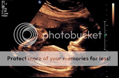 22 week ultrasound pics! - BabyCenter