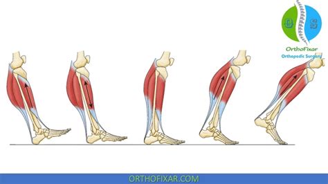 Gait Cycle: Phases & Biomechanics | OrthoFixar 2024