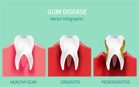 How Does Gum Disease Affect Your Overall Health?