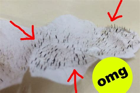 17 Oddly Satisfying Pictures Of Used Pore Strips