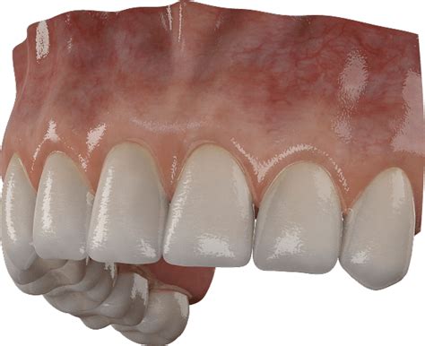 Free 3D Teeth Model | 3D Gladiator