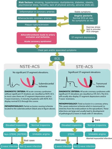 STEMI (ST Elevation Myocardial Infarction): diagnosis, criteria, ECG & management ...