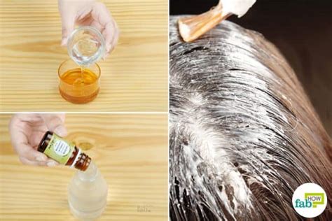 8 Best Home Remedies for Dry, Flaky Scalp That Work | Fab How