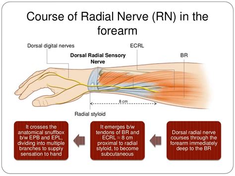 Radial nerve palsy