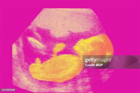 57 22 Weeks Pregnant Ultrasound Stock Photos, High-Res Pictures, and Images - Getty Images