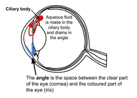 Narrow angles - Neuro-Ophthalmology