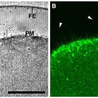 The spikes protruding into the perivitelline space during fertilization... | Download Scientific ...