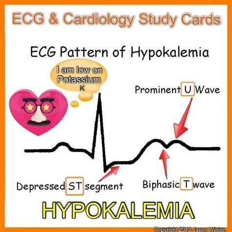 medical cartoon hypokalemia - Google Search Nursing Study Tips, Nursing ...