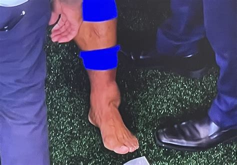 Saquon Barkley suffers gruesome looking ankle injury