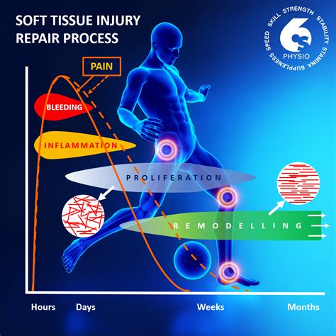 Soft Tissue Injury Management - PEACE then LOVE - 6S Physio