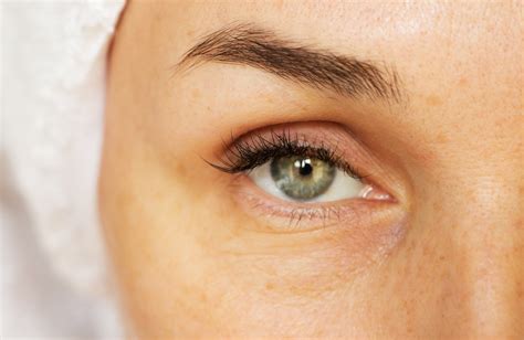 The Magical and Wrinkle-Erasing Benefits of Under Eye Fillers - My Botox LA Med Spa News & Articles