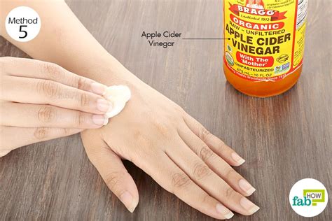 11 Popular Home Remedies for Itchy Skin | Fab How