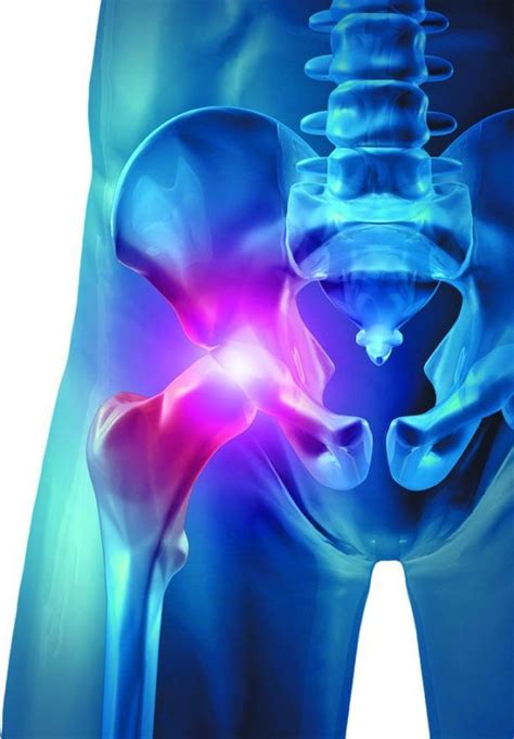 Troubleshooting Hip Pain: Part II - Arthritis Advisor