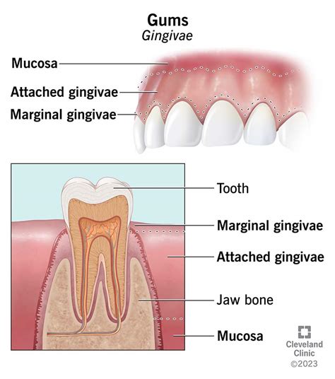 What Are Gums (Gingivae)?