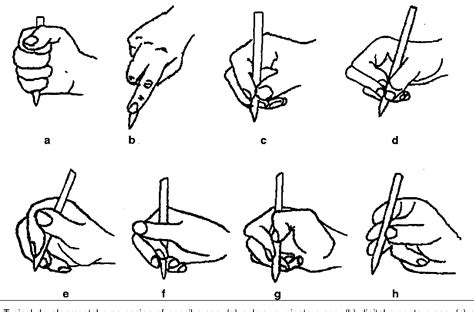 Figure 1 from Pencil grasp and children's handwriting legibility during different-length writing ...