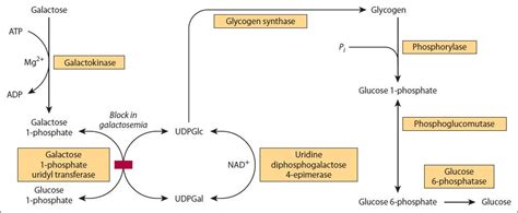 12 Carbohydrates: Galactose Metabolism | Basicmedical Key