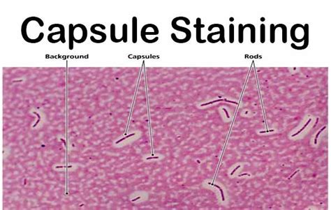 Capsule Staining- Principle, Reagents, Procedure and Result