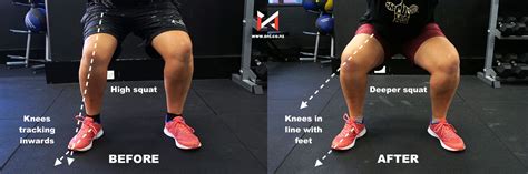 Valgus Knee [Case Study - Alec] — ONI | Wellington Personal Training Studio