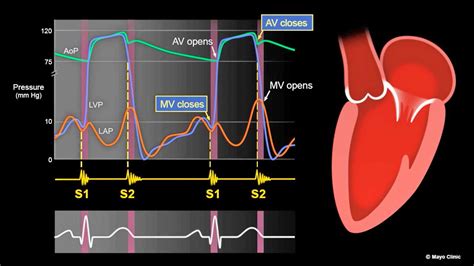 Top 143+ Heart sounds animation - Merkantilaklubben.org