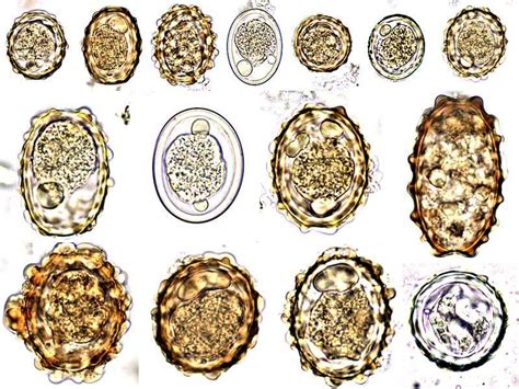 Ascaris lumbricoides egg | Medical Laboratories