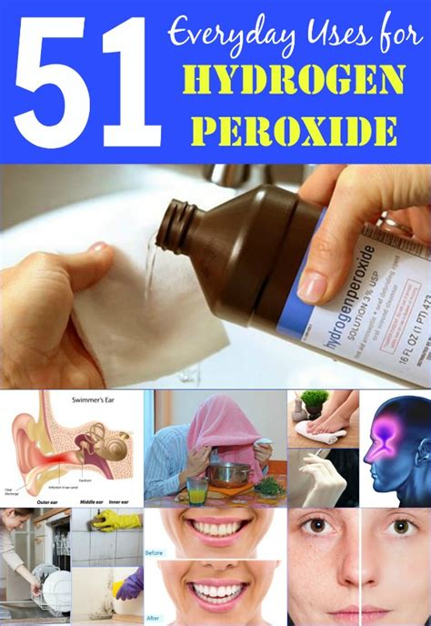 51 Extraordinary Everyday Uses for Hydrogen Peroxide — Info You Should Know