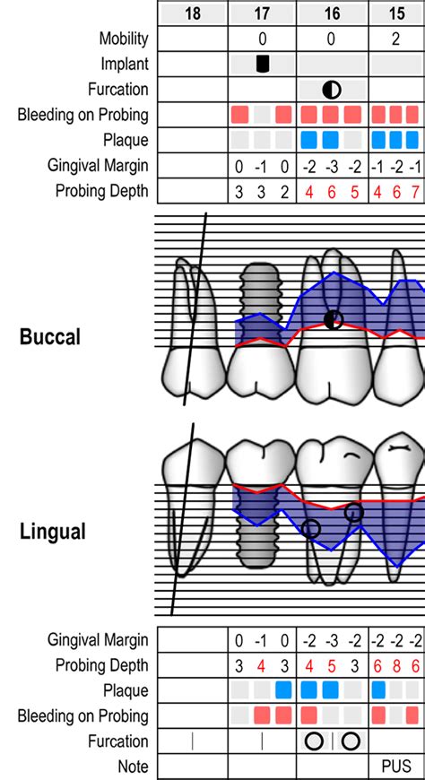 Periodontal Chart online - www.perio-tools.com