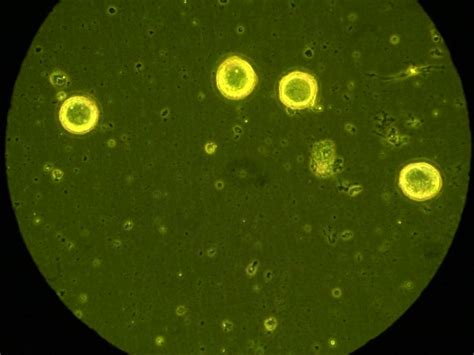 Isolation of Sensory Neurons of Aplysia californica for Patch Clamp Recordings of Glutamatergic ...