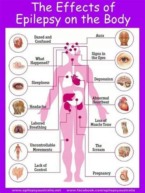 Epilepsy Effects On The Brain