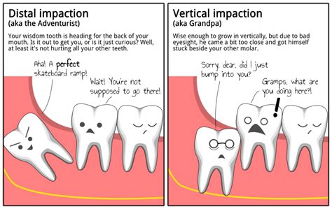 When Wisdom Teeth Grow – Boston Dentist – Congress Dental Group 160 Federal St Floor 1, Boston ...