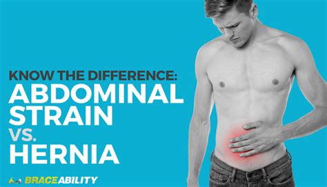 Know The Difference: Abdominal Strain vs. Hernia