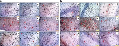 a Immunohistochemical labelling of light chain neurofilaments (NF-l) in... | Download Scientific ...