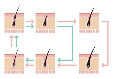 Comparing Normal Hair Growth Cycle To Androgenetic Alopecia Vector ...