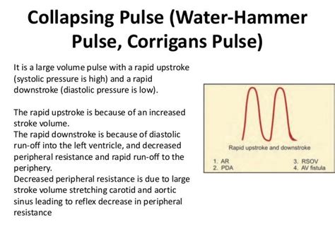 Pulse & JVP