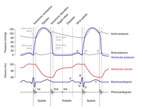 Phonocardiogram - Wikipedia