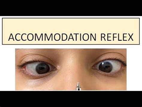 Accommodation Reflex - YouTube