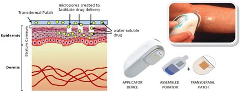 Transdermal Patch Chart