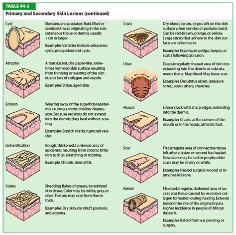 The Best 29 Primary Skin Lesions Types - Infuzionit