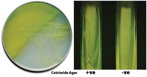 Cetrimide Agar- Composition, Principle, Preparation, Results, Uses